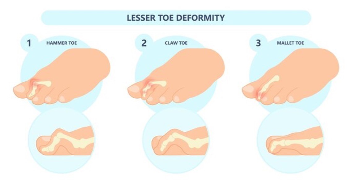 forest foot health logo